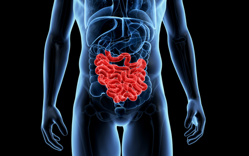 i2i News Trivandrum,health, intestine cancer, i2inews 