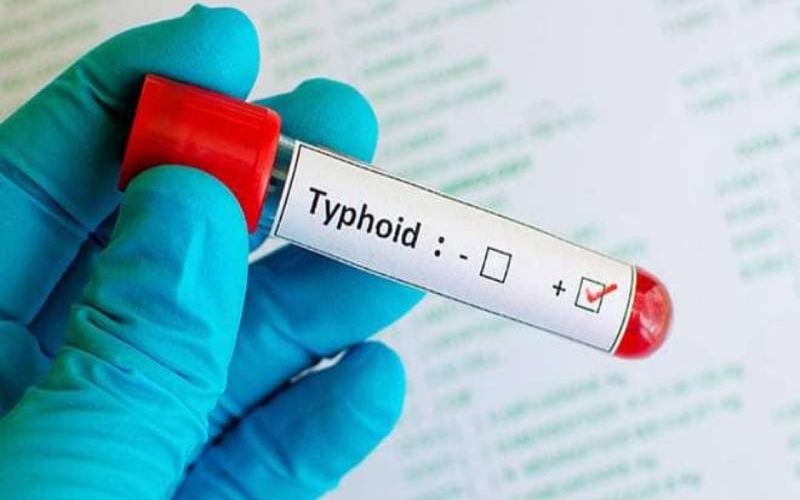 i2i News Trivandrum,typhoid, fever, i2inews 